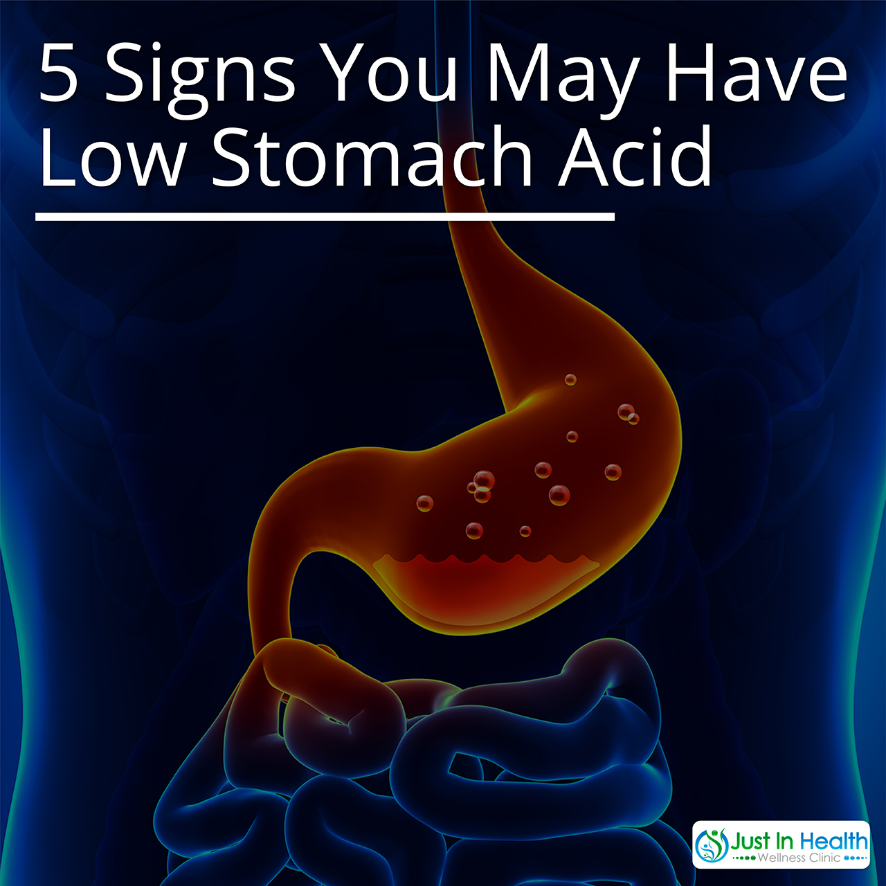 5 Signs You May Have Low Stomach Acid