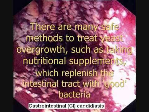 candida in the intestines