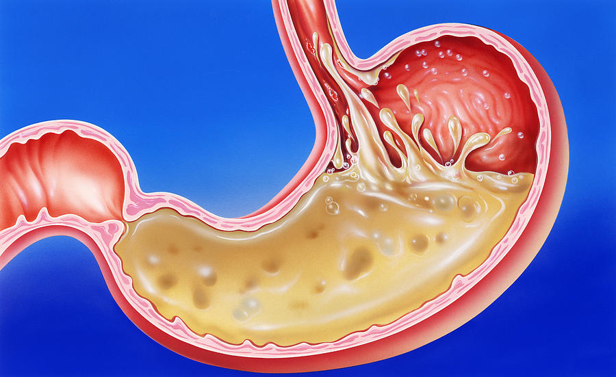 What Is The Role Of Hydrochloric Acid In The Stomach For Class 7