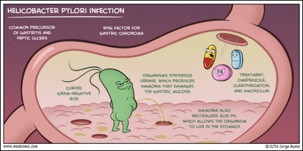 H. pylori infections
