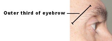eye_brow_and_thyroid