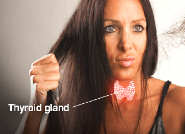 Thyroid problems and hair loss