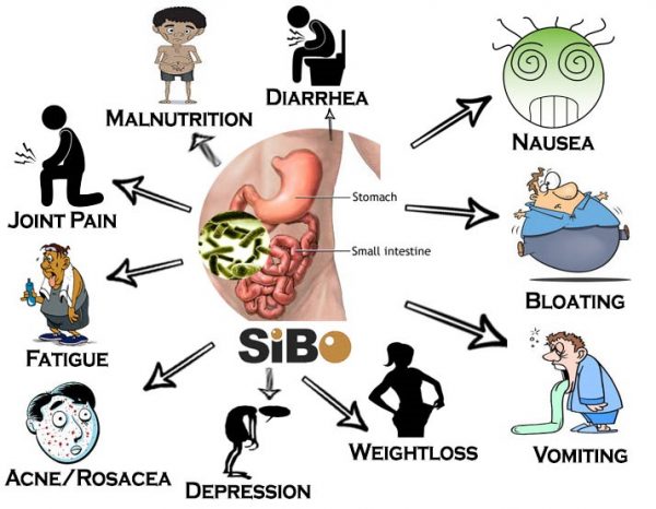 SIBO - small intestinal bacterial overgrowth