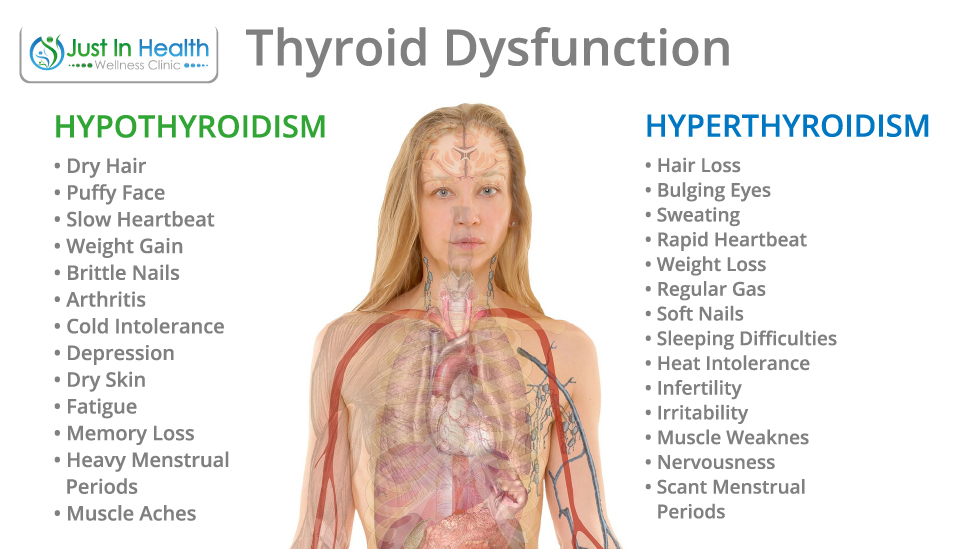 SIGNS OF THYROID ISSUES