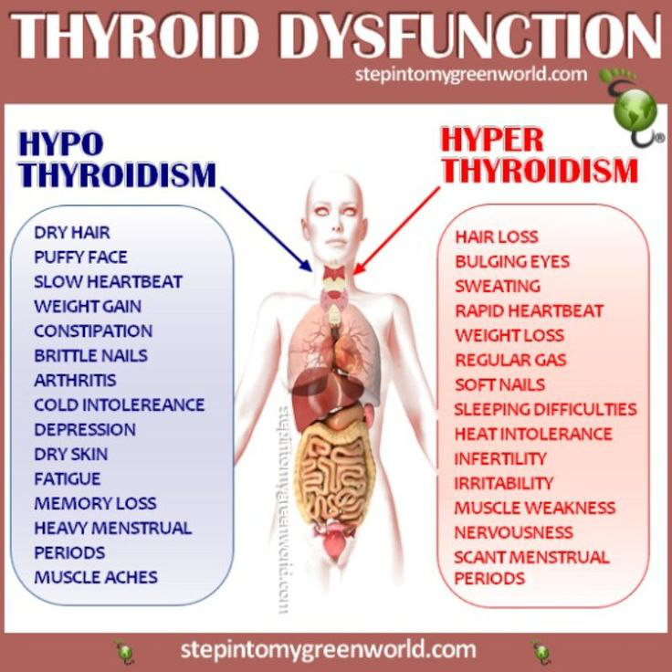 Does Thyroid Cause Low Blood Sugar