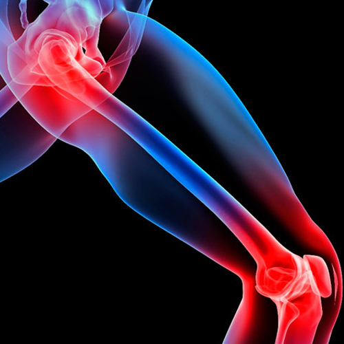 How to Treat Joint Pain