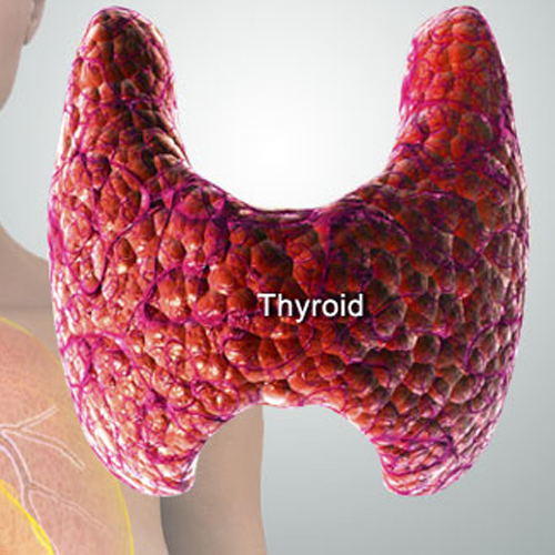 Hashimoto's Triggers Autoimmune Thyroid