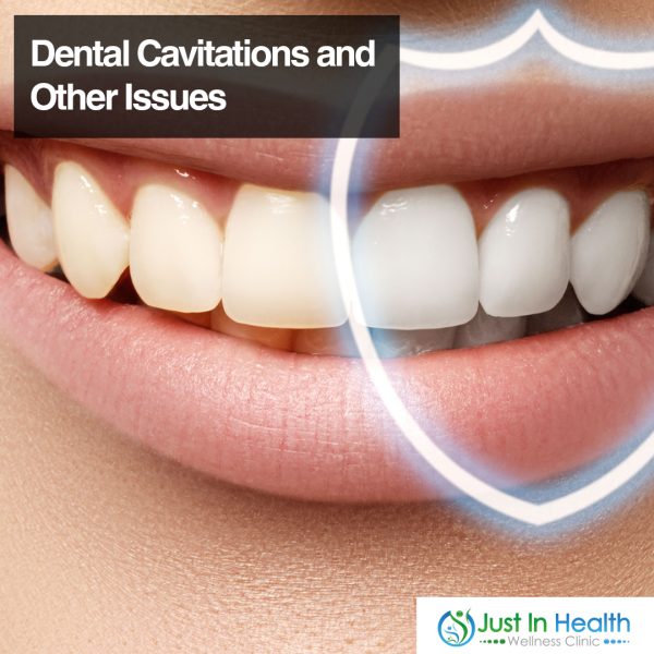 Dental Cavitations and Other Issues
