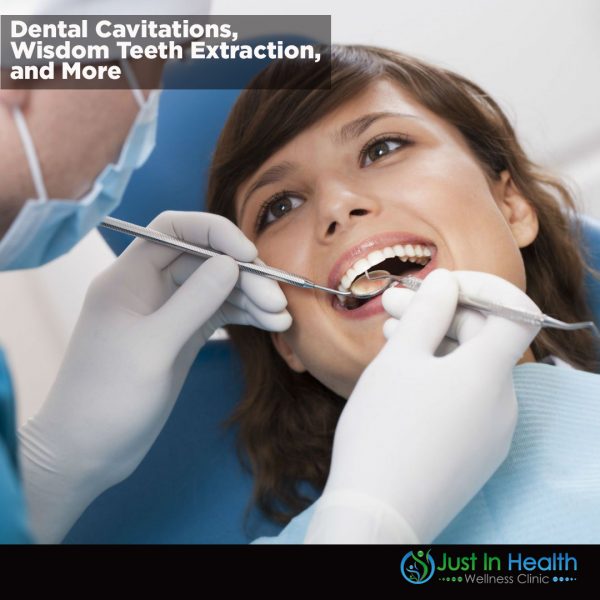 Dental Cavitations, Wisdom Teeth Extraction, and More