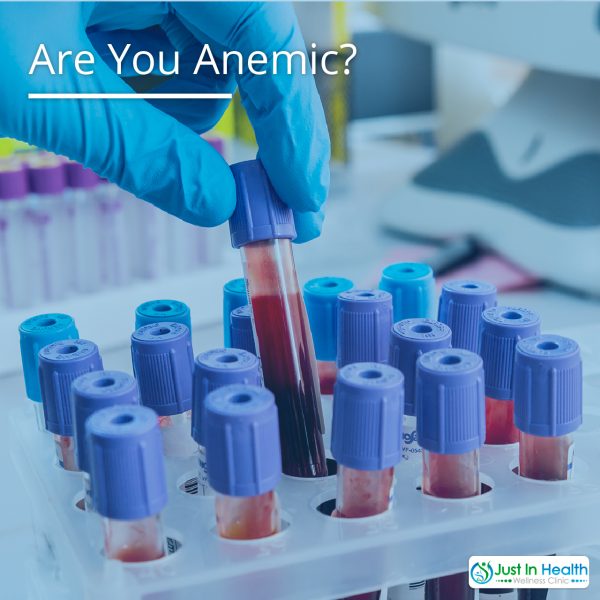 Are You Anemic?