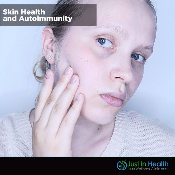 Skin Health And Autoimmunity Square