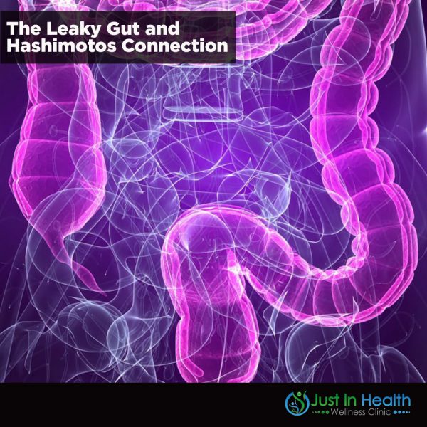 The Leaky Gut and Hashimoto's Connection