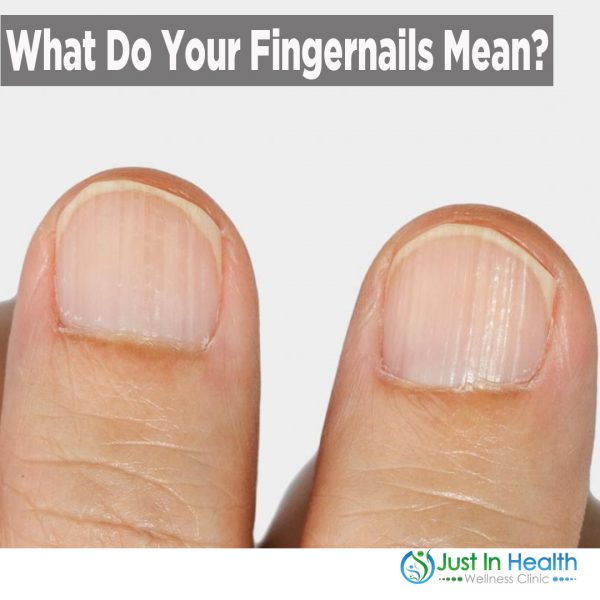 What Do Your Fingernails Mean