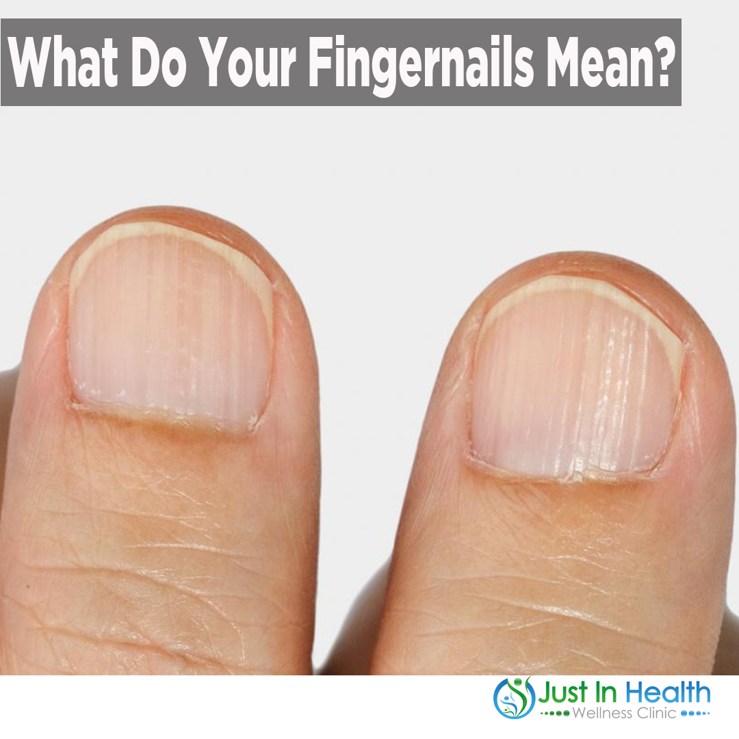 what-do-your-fingernails-mean-podcast-253