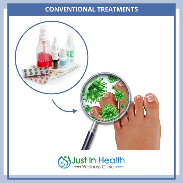 How To Treat Toenail Fungus or Discoloration Austin Texas Functional