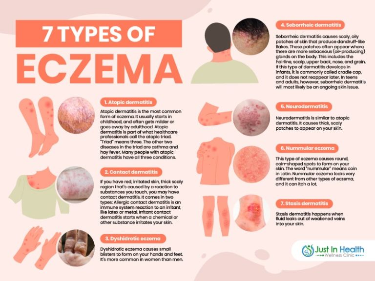 7 Types Of Eczema Podcast #361-min - Austin Texas Functional Medicine ...