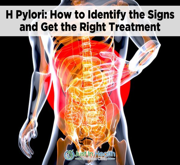 H Pylori How to Identify the Signs and Get the Right Treatment 2