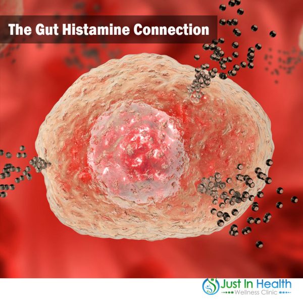 The Gut Histamine Connection | Podcast 384