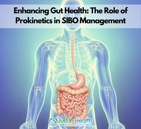Enhancing Gut Health: The Role of Prokinetics in SIBO Management
