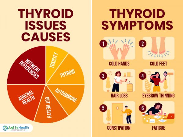 Thyroid Issues Causes and Symptoms
