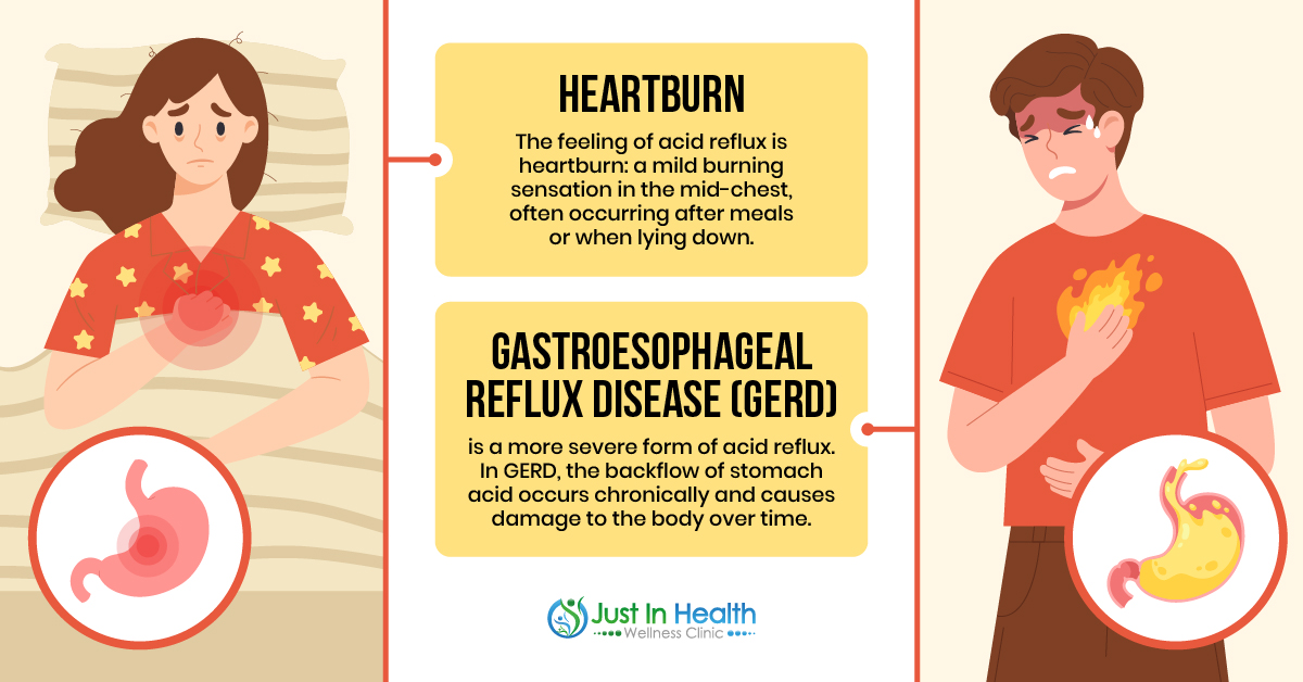 Heartburn vs. GERD