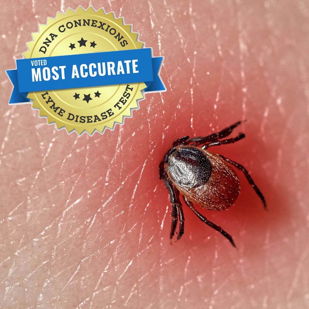 the-dna-connexions-lyme-disease-test-austin-texas-functional