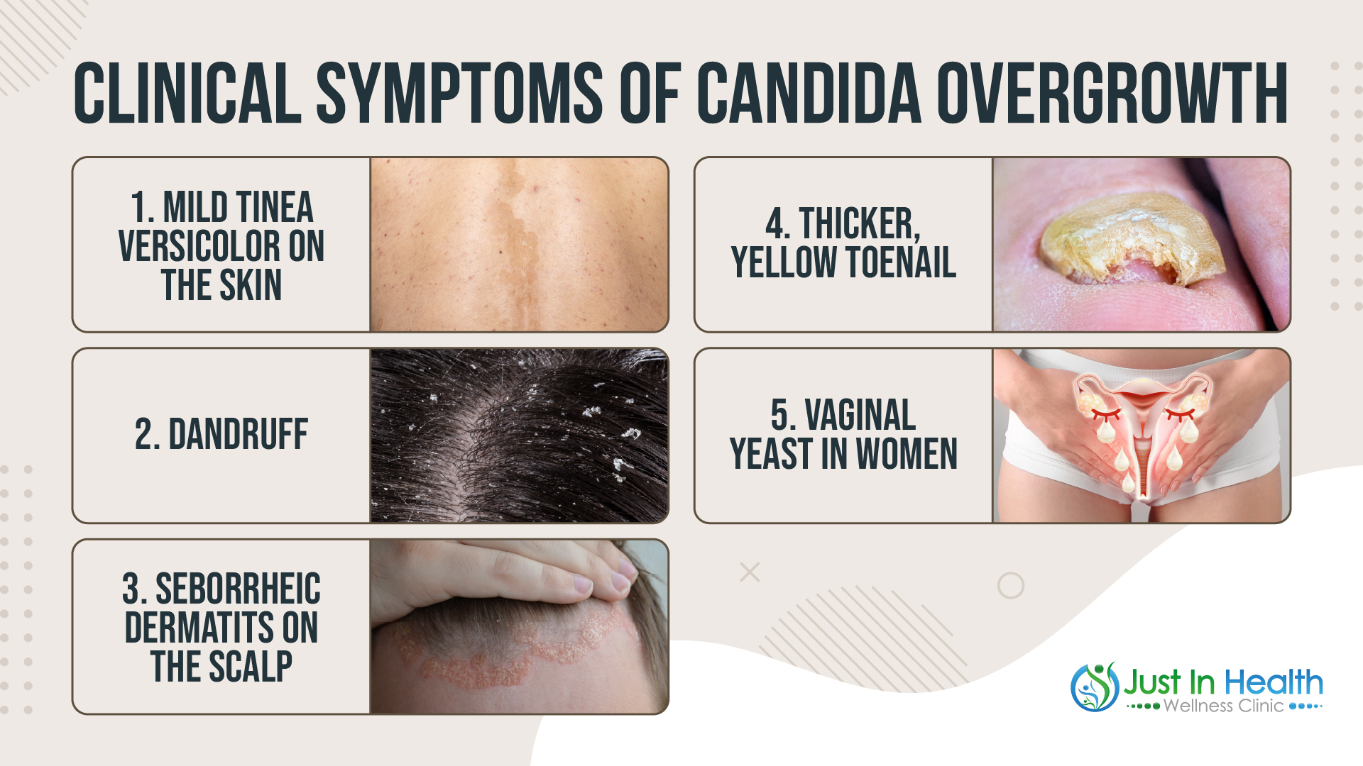 Clinical Symptoms of Candida Overgrowth_Dr. Justin Marchegiani