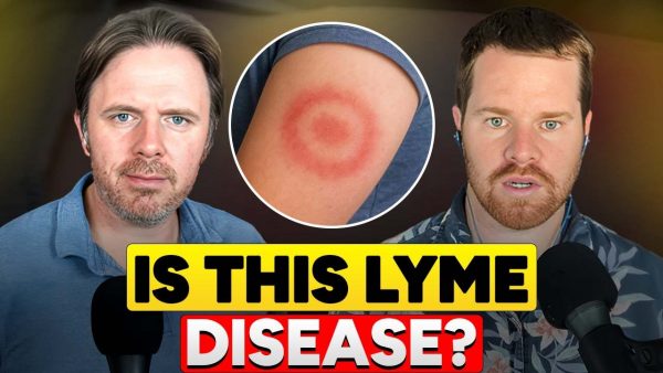 Chronic Lyme Disease Explained: Root Causes, Co-Infections, and Natural Treatment Strategies